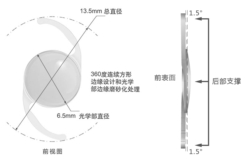 Proming普諾明大光學區高次非球面人工晶狀體ALD